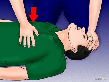 CPR on an Adult