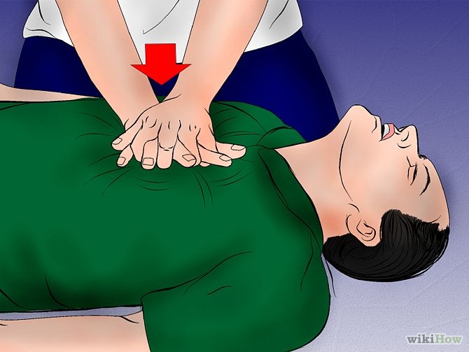 CPR on an Adult